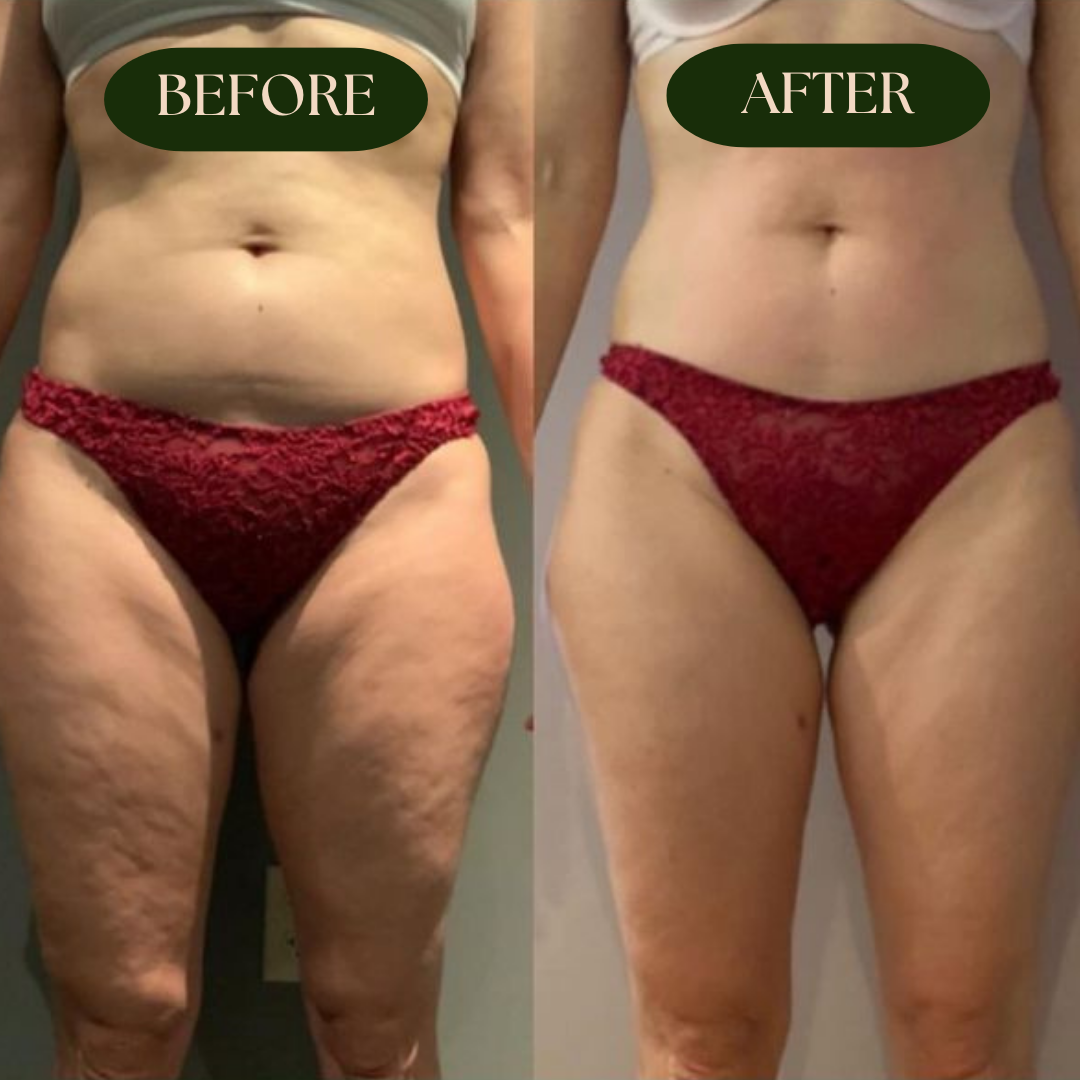 BODY SCULPTING BOARD