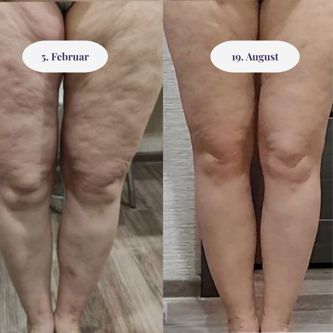 FORMEND & GLÄTTEND LEGGING